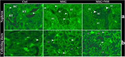 Effect of Nigella sativa L. Seed on the Kidney of Monosodium Glutamate Challenged Rats